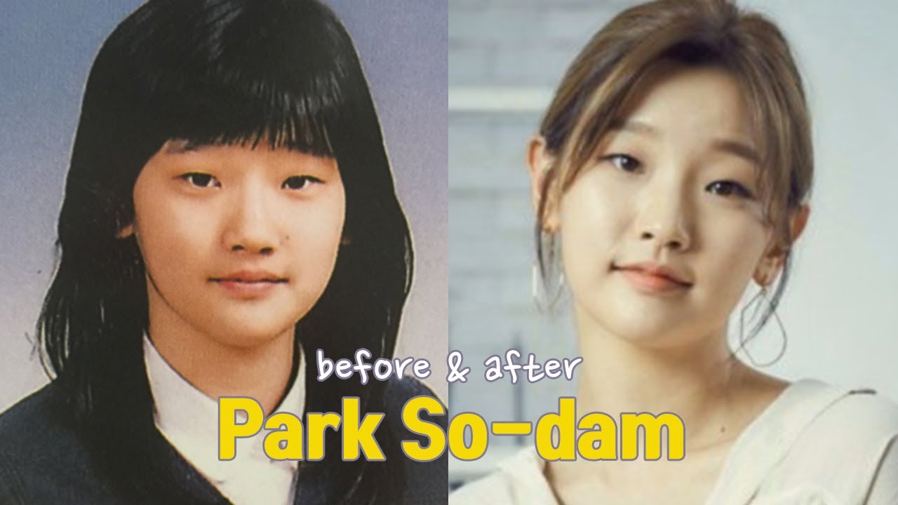 Park So-dam before and after