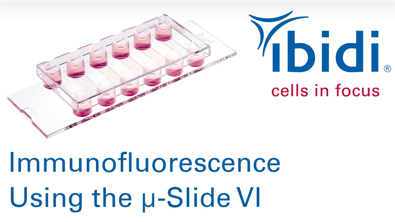 ibidi - cells in focus: Immunofluorescence Using the µ-Slide VI