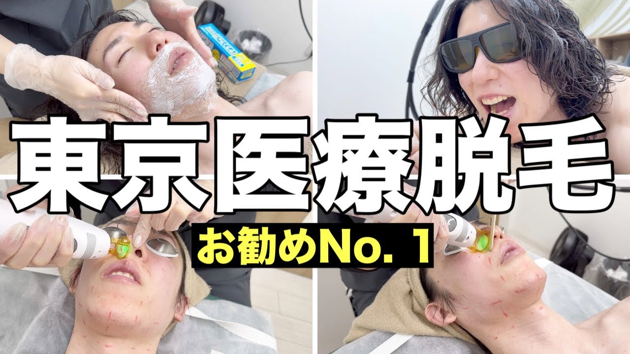 東京でコスパ最強の医療脱毛はここで間違いない！髭脱毛、全身脱毛、VIO脱毛、ミラノリピールをコスパ最強&安心して契約できるクリニックゼロプラスで受けてきた！