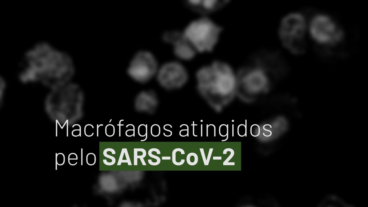 Macrófagos atingidos pelo SARS-CoV-2
