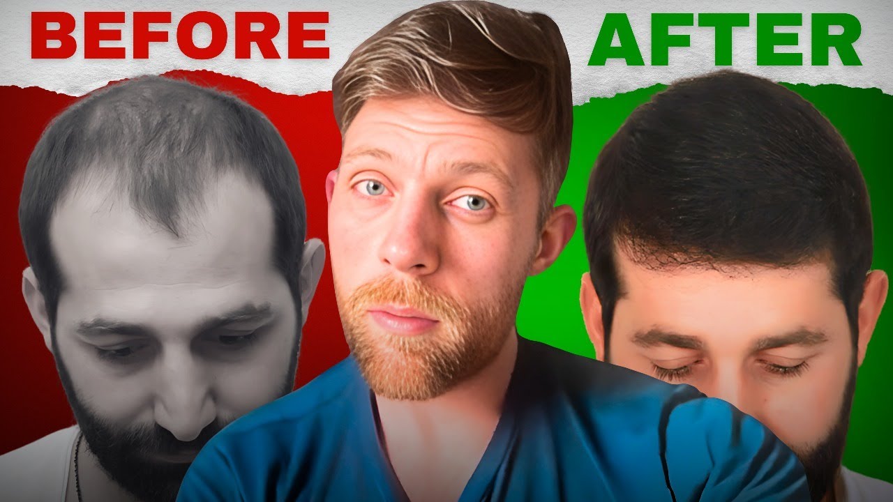 Why Short Hair Systems Are Perfect for Beginners!