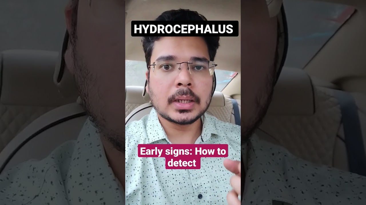 early signs of HYDROCEPHALUS #hydrocephalus