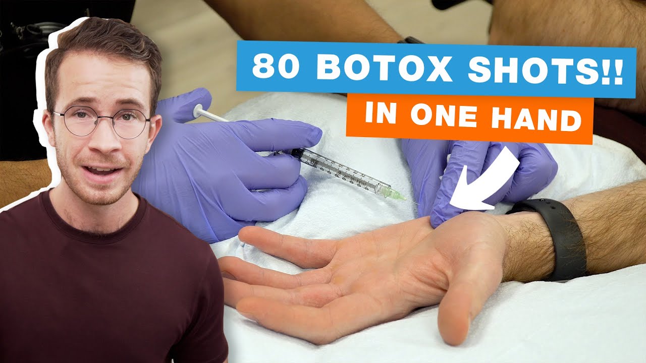 Sweaty Palms? Is Botox the Ultimate Sweat Solution?