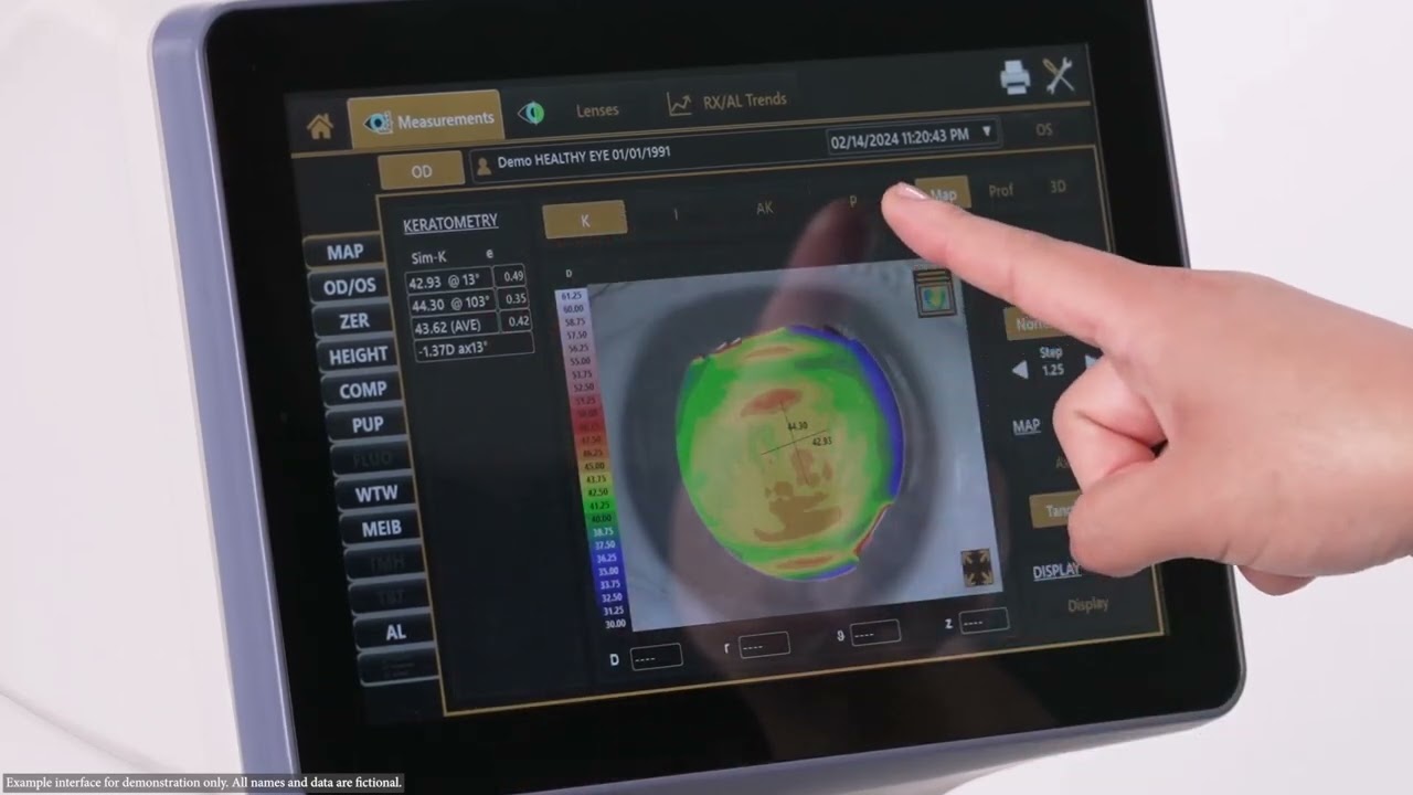 Reviewing topography data captured on the Topcon MYAH
