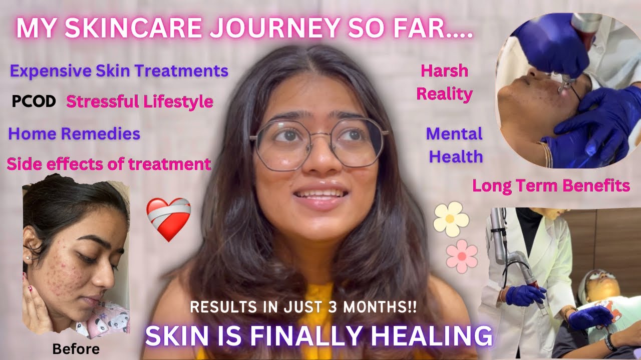 My Skincare Journey So Far ❤️‍🩹 | *EXPENSIVE* Skin Treatments Reality | Gauri Gajare Official