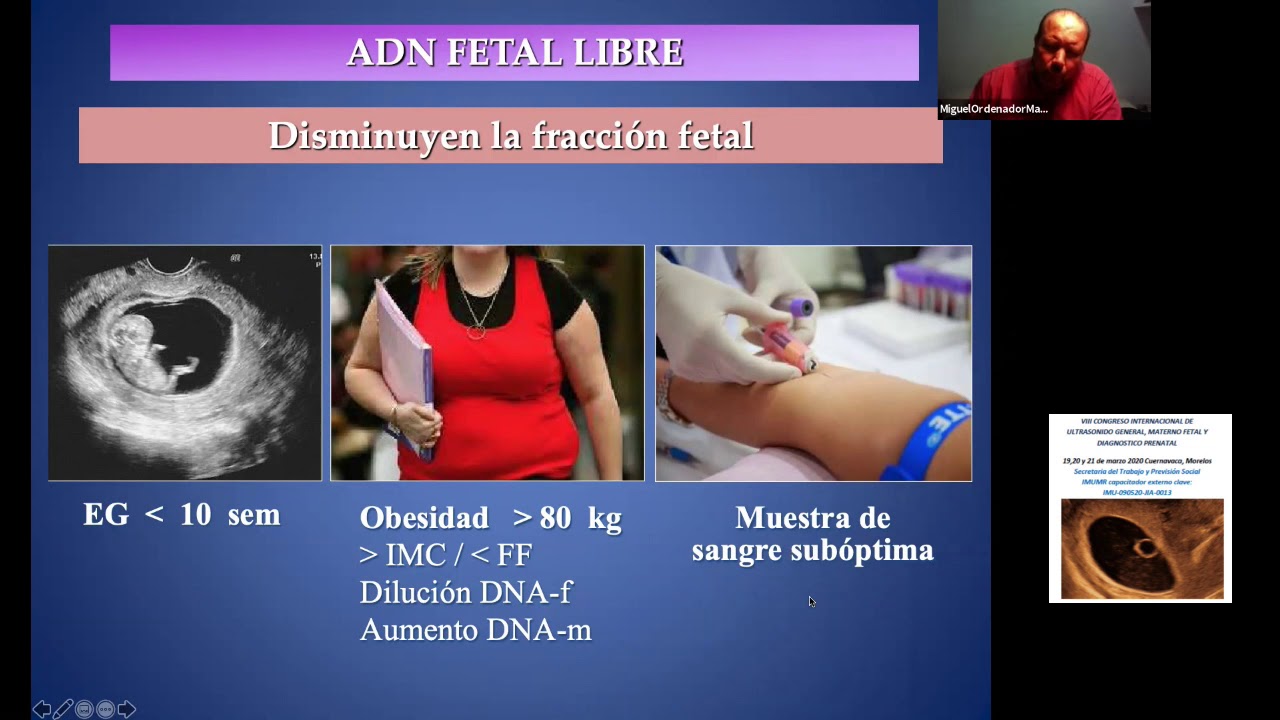 ADN fetal en sangre materna