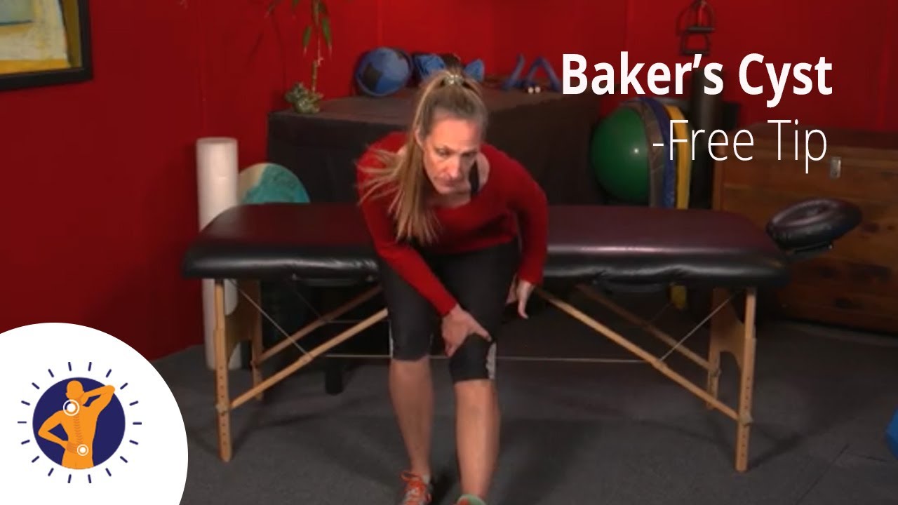 Baker's Cyst - Free Tip