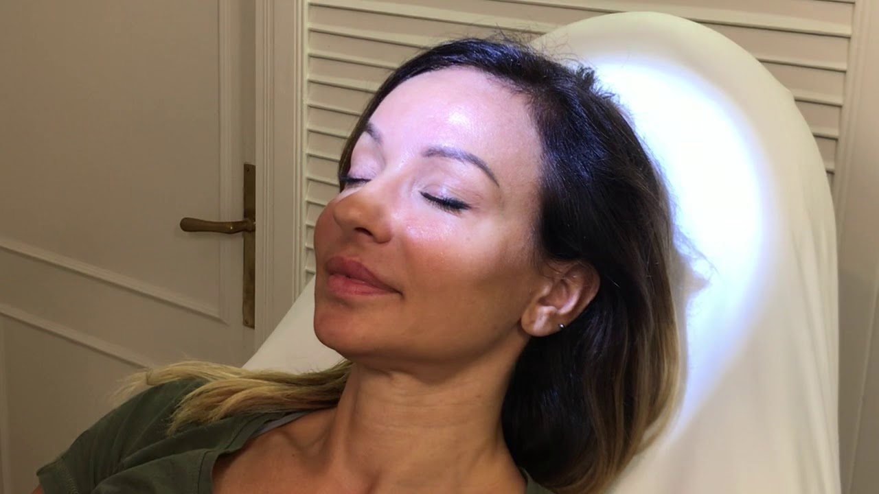 Botox fronsrimpels/booskijkrimpels den haag