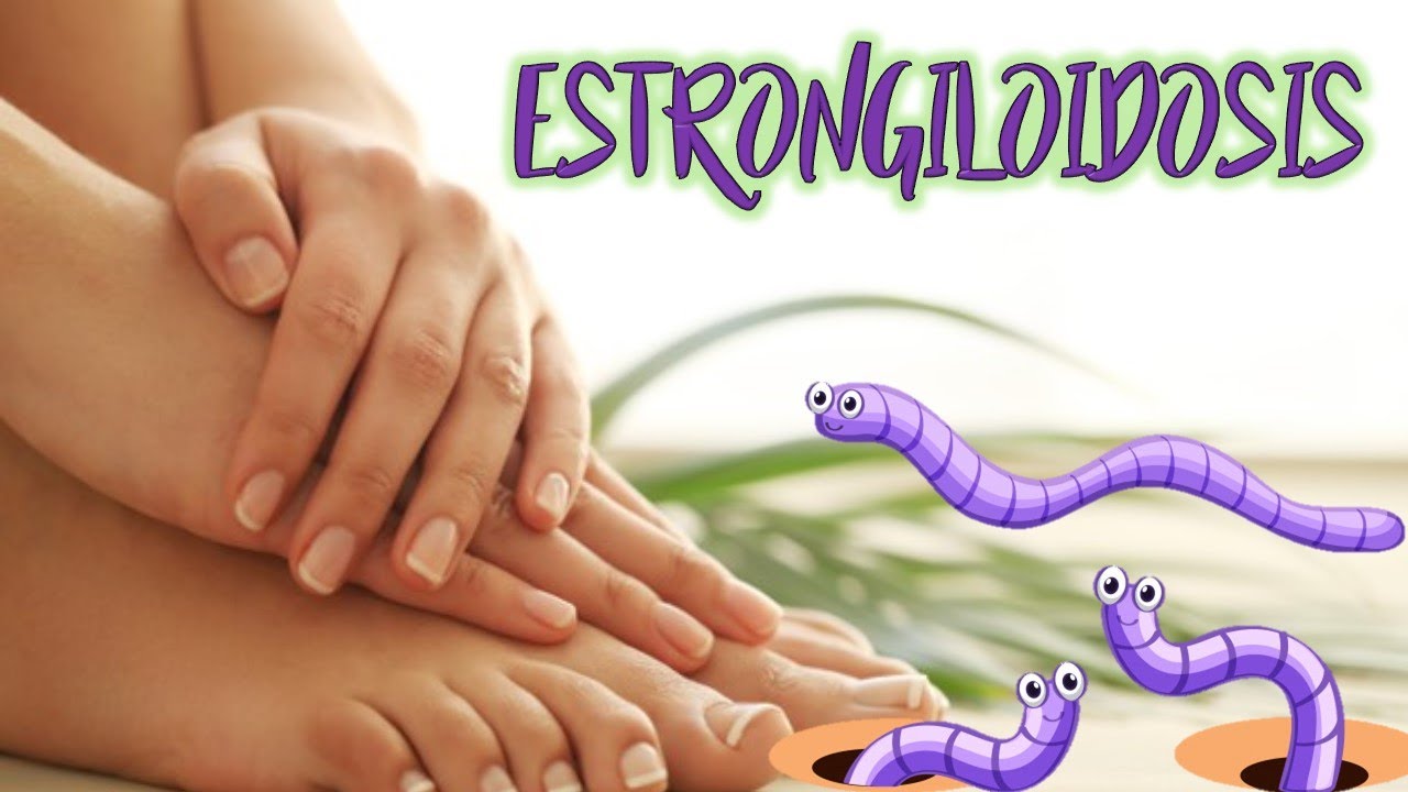 Estrongiloidosis, el Parásito que entra por la Piel