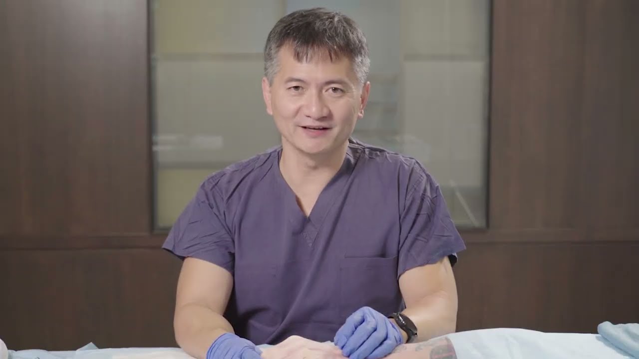 Jerry Huang, MD IM Metacarpal Fracture Technique with OSSIOfiber&reg; Threaded Trimmable Fixation Nail