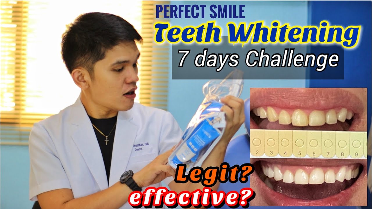WHITER TEETH: 7 Days Challenge with PERFECT SMILE, Effective nga ba?