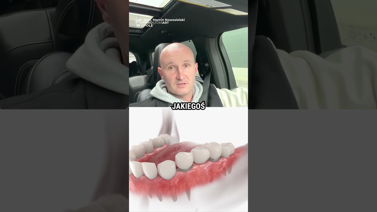 MOST vs IMPLANT? 🌉🦷 Dentysta: Robię Most Tylko Wtedy Gdy...