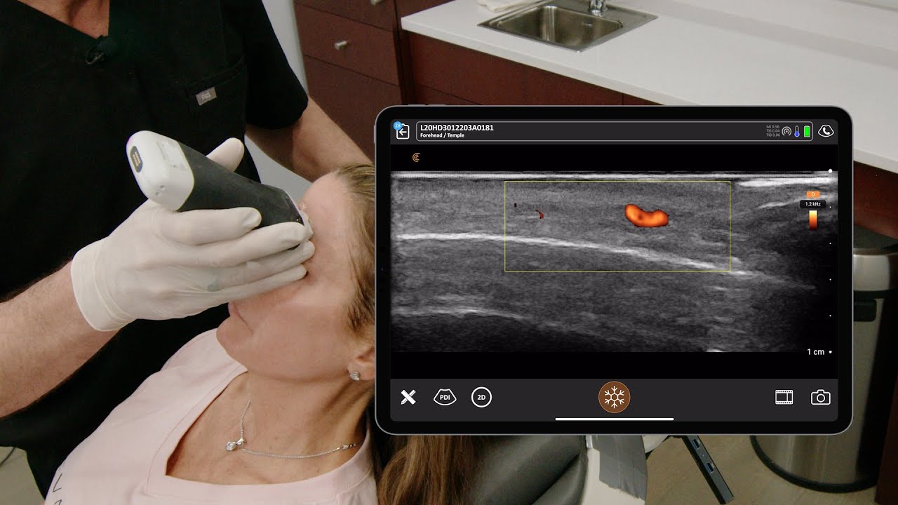 Ultrasound Evaluation of the Midline Forehead