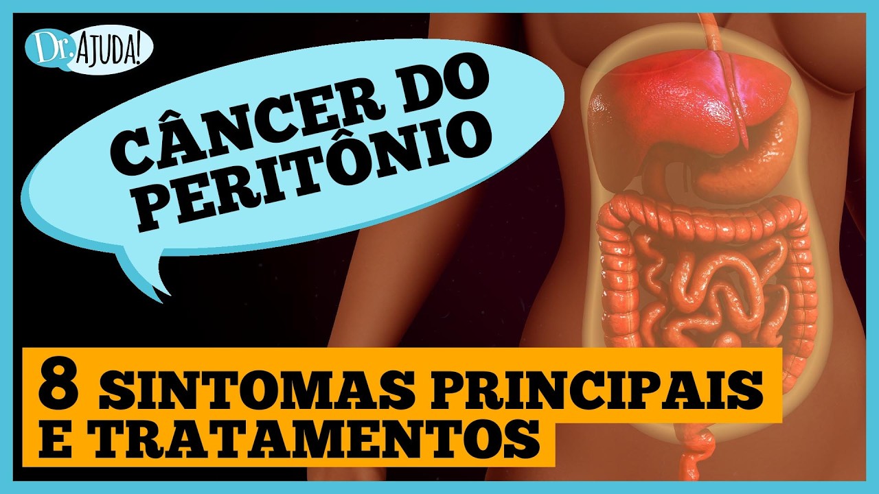 CÂNCER DE PERITÔNIO: sintomas, diagnóstico e tratamento