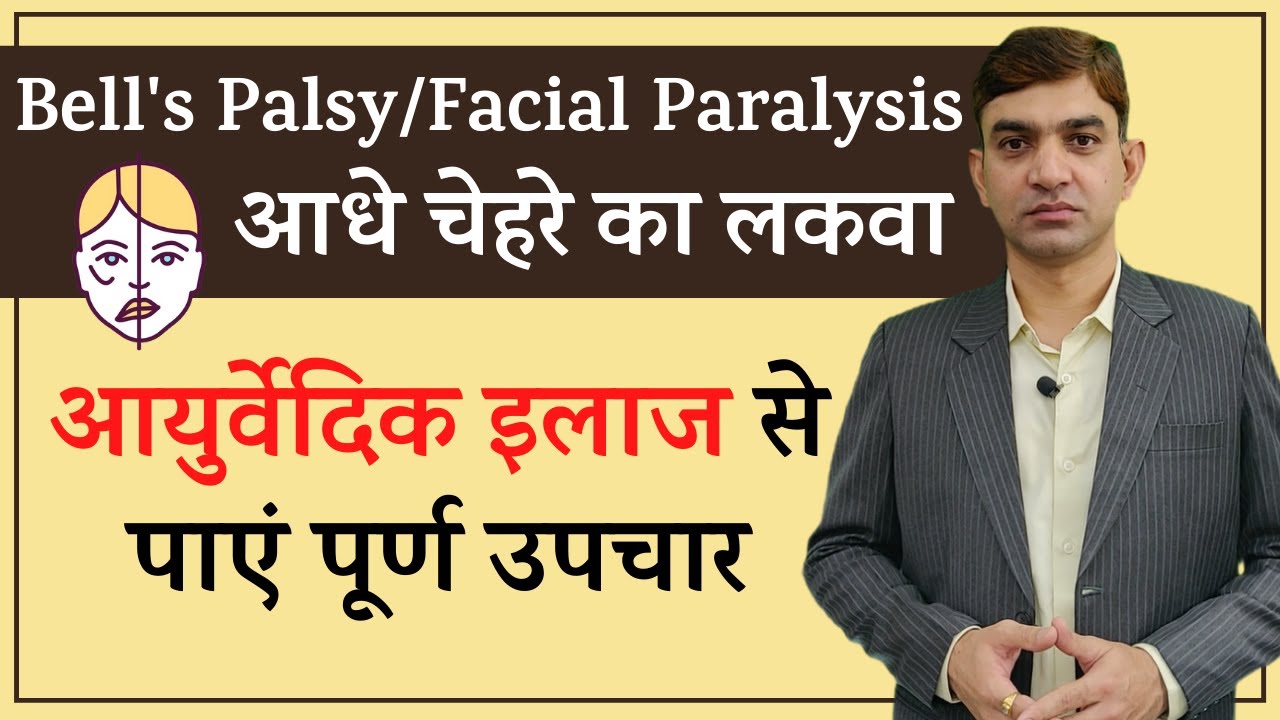 Facial Paralysis or Bell's Palsy Treatment in Ayurveda || आधे चेहरे के लकवे का आयुर्वेदिक उपचार