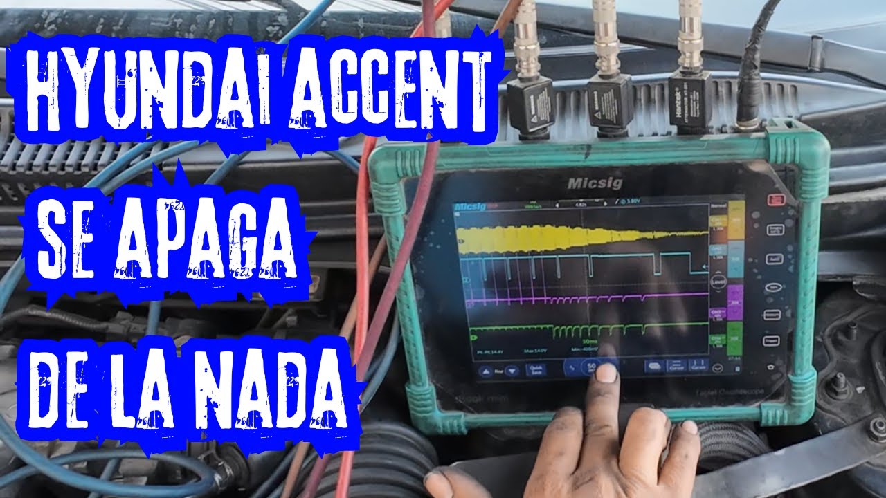 Hyundai Accent se apaga por momentos - enfría y vuelve a prender - enciende cuando quiere