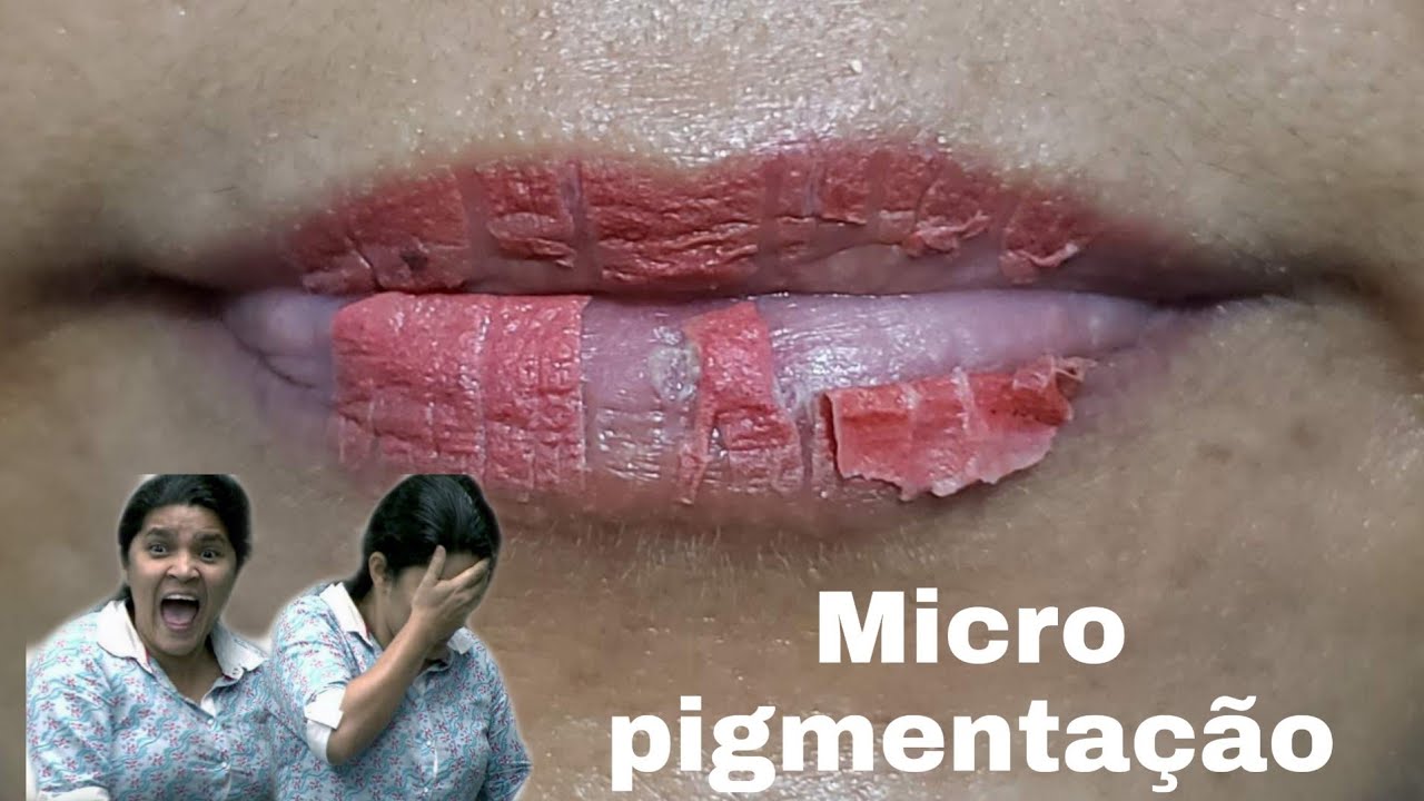 Micropigmentação labial cicatrização