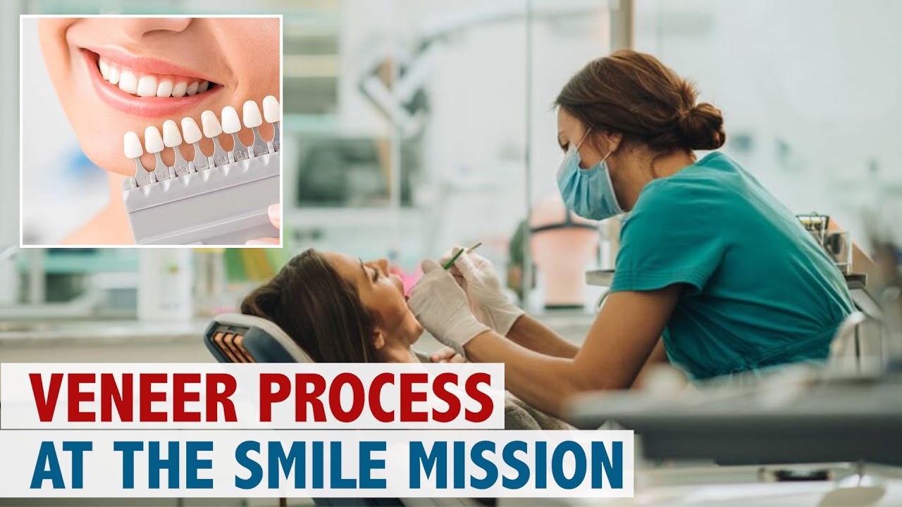 Veneer Process at The Smile Mission