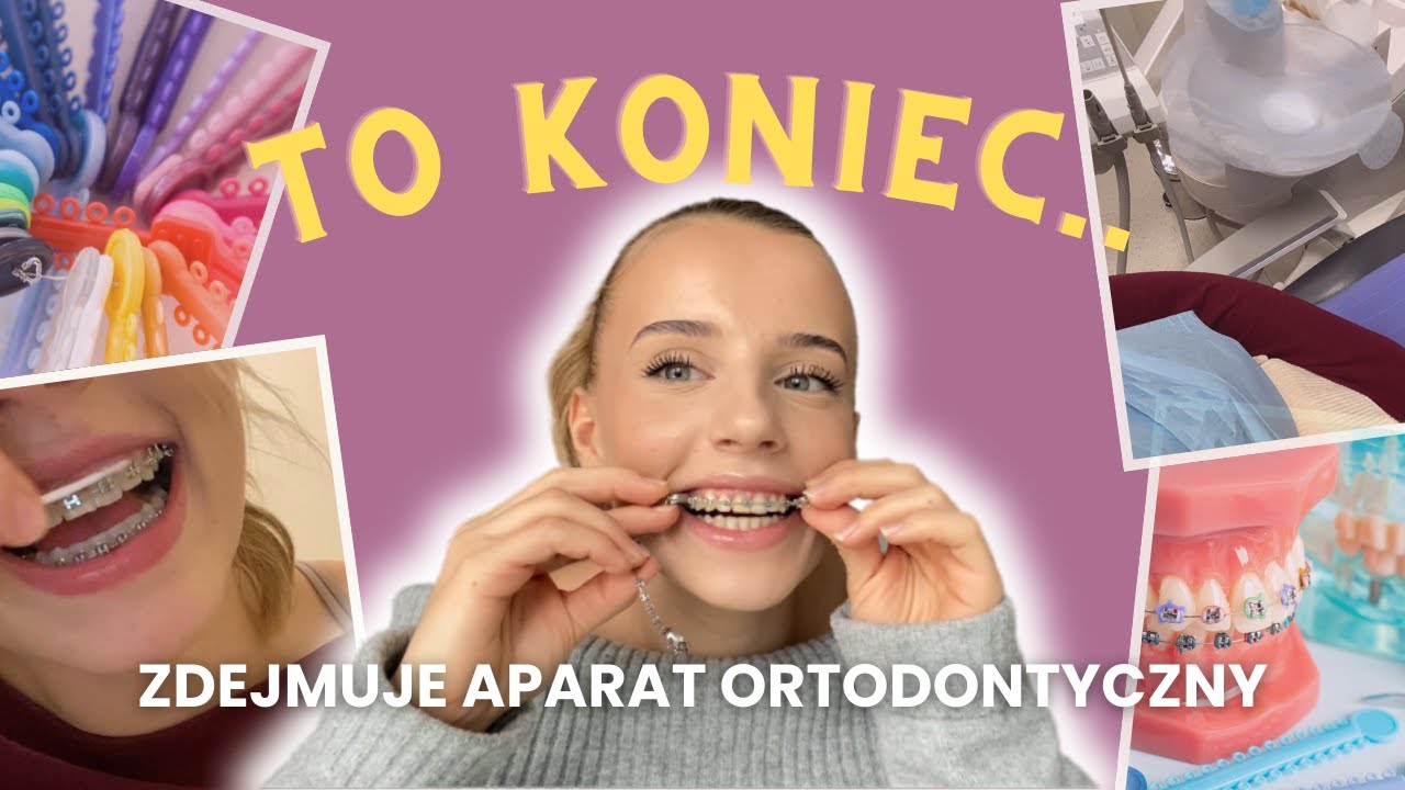 VLOG: Zdejmuje aparat ortodontyczny.. Jak wygląda wizyta i czy to boli?    📸🦷