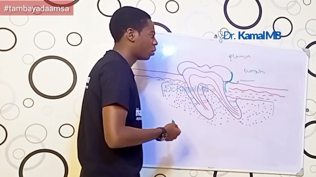 Zubar jini daga daddashi #drkamalmb #jini #dadashi #hakori #lafiya_jari #viral #trending