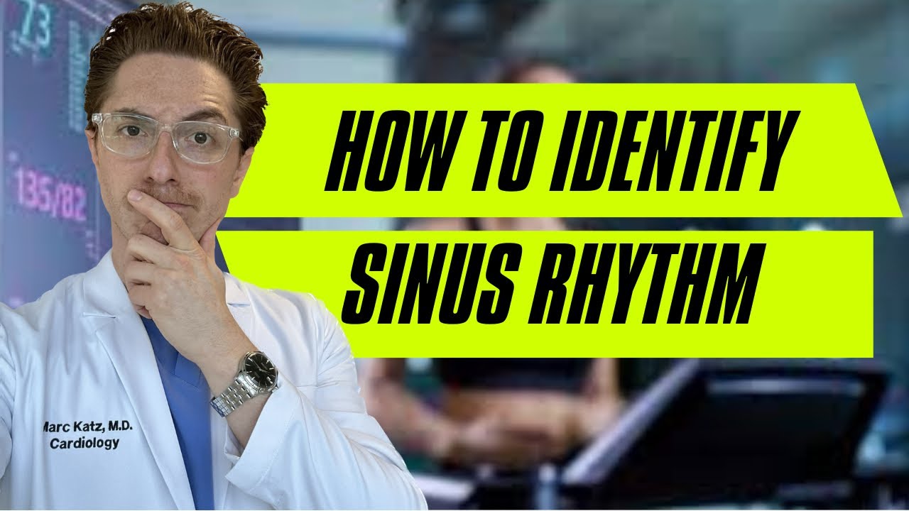 How to Identify Sinus Rhythm on ECG