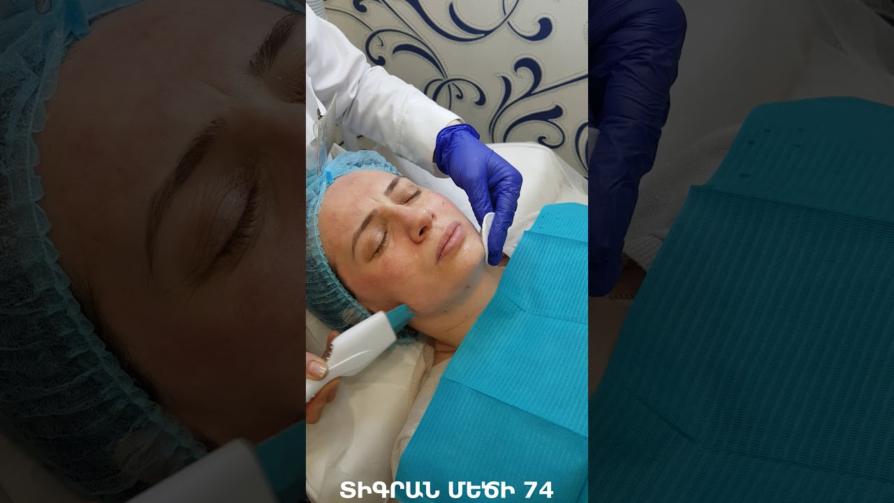 Ուլտրաձայնային մաքրում