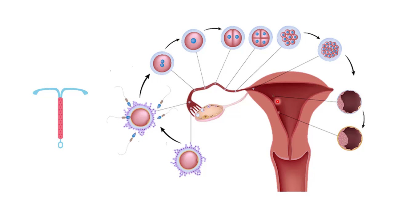 30- التكاثر عند الإنسان ، الجزء4 : تنظيم النسل+تقنيات في عمليتي الإخصاب والحمل ، أحياء توجيهي الأردن