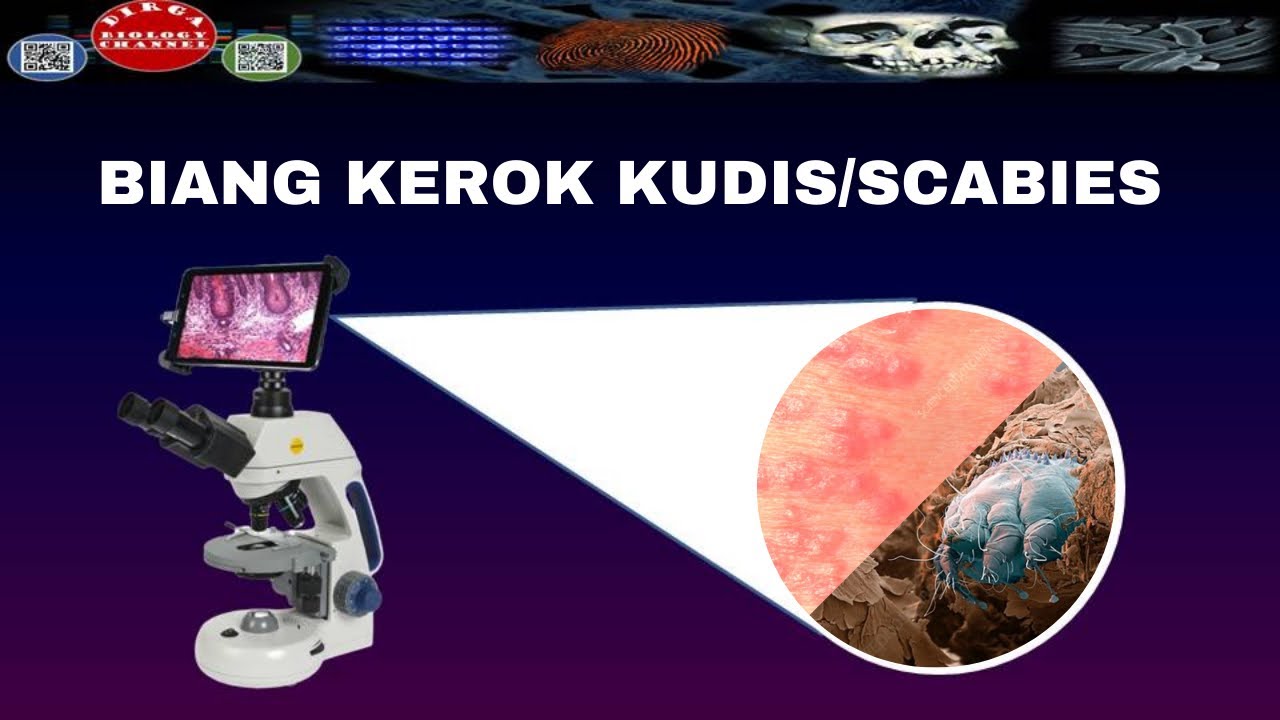 ZOOM MIKROSKOP...TUNGAU PENYEBAB KUDIS/SCABIES/GUDIK - DIRGA BIOLOGY CHANNEL