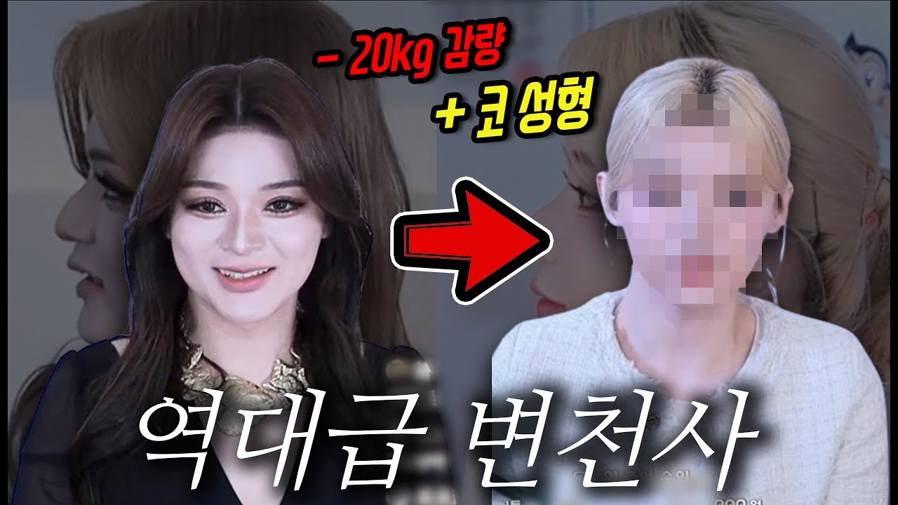 가게 오픈 후 20kg 감량에 코 성형까지.. 그 결과는?