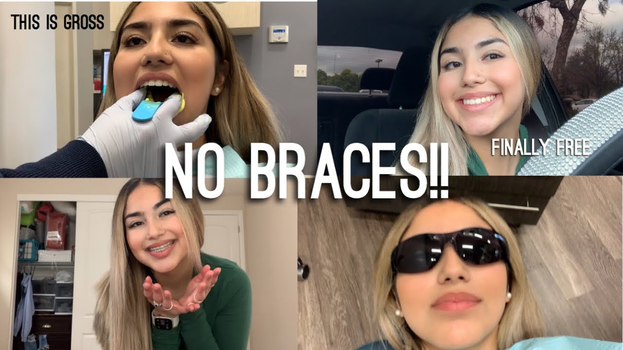 Finally getting my BRACES REMOVED *Vlog*.