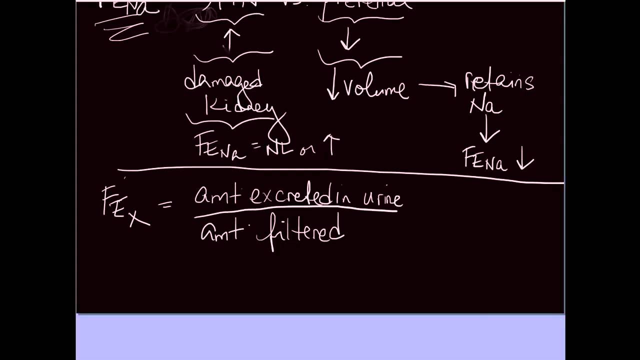 10-minute Rounds:  The Fractional Excretion of Sodium - How to calculate