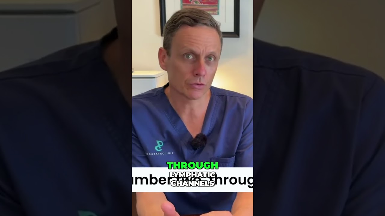 Распространение рака простаты: 3 способа, о которых вам следует знать!