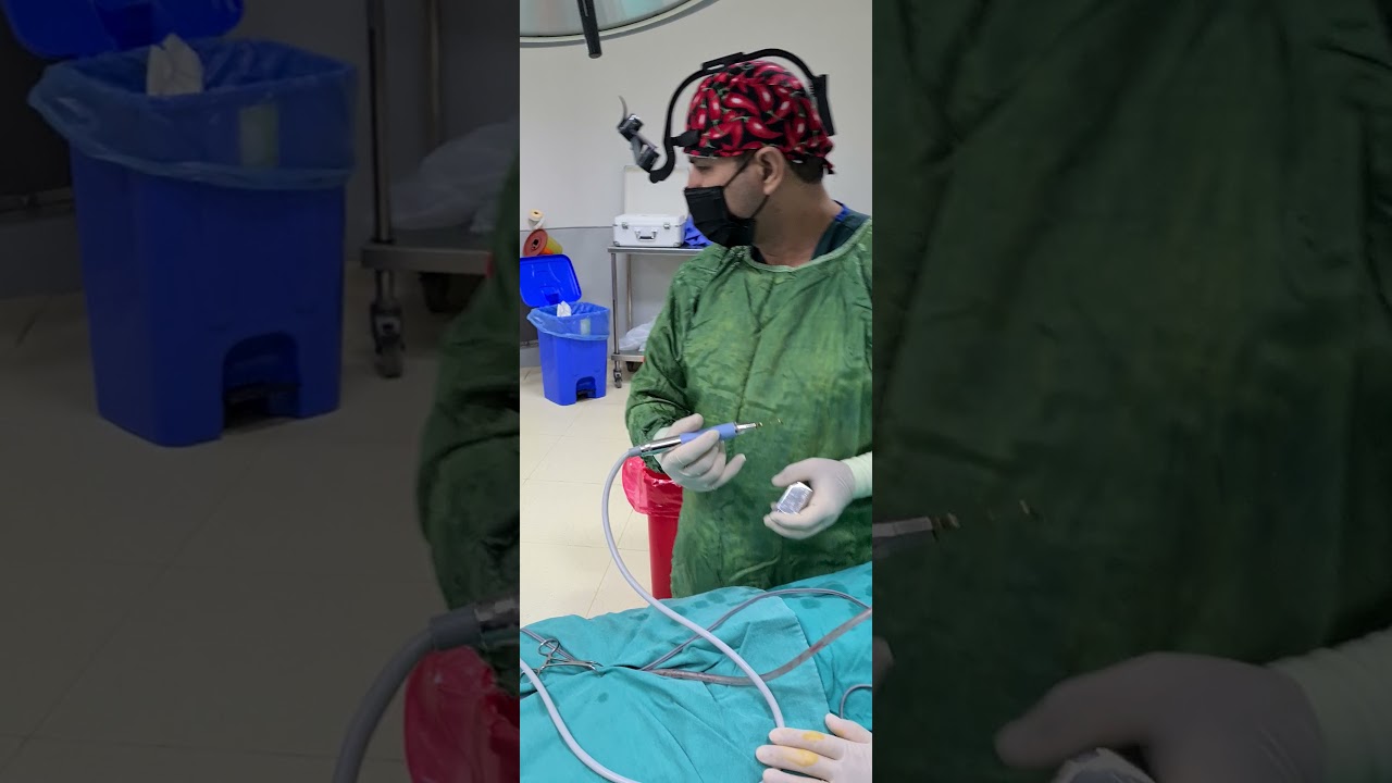 ultrasonik(piezo)burun estetiği