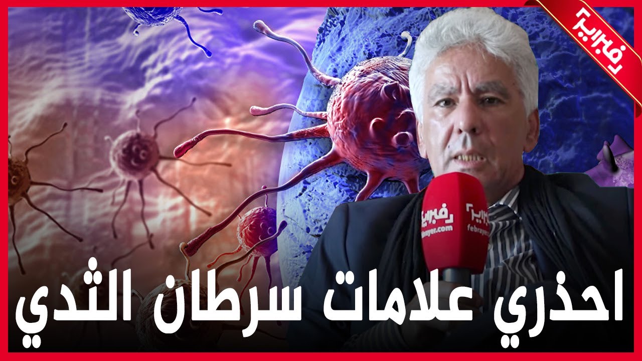 الدكتور القادري.. احذري علامات سرطان الثدي وانتبهي لأمانة الطبيب
