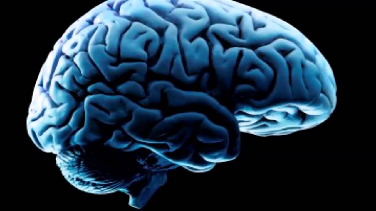 Acephalgic Migraine