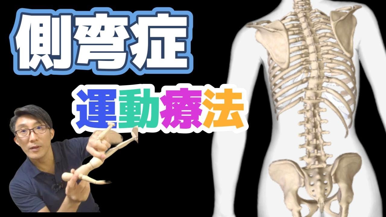 側弯症の治しかた メカニズムと運動療法