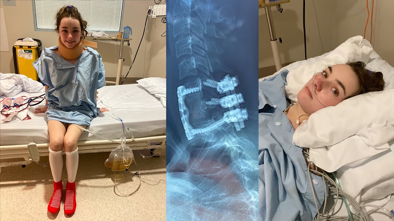 i had NECK SURGERY for the 2nd time!