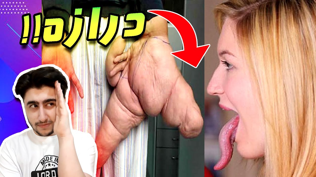 یازده 11 تا از دراز ترین اعضای بدن 😮😲