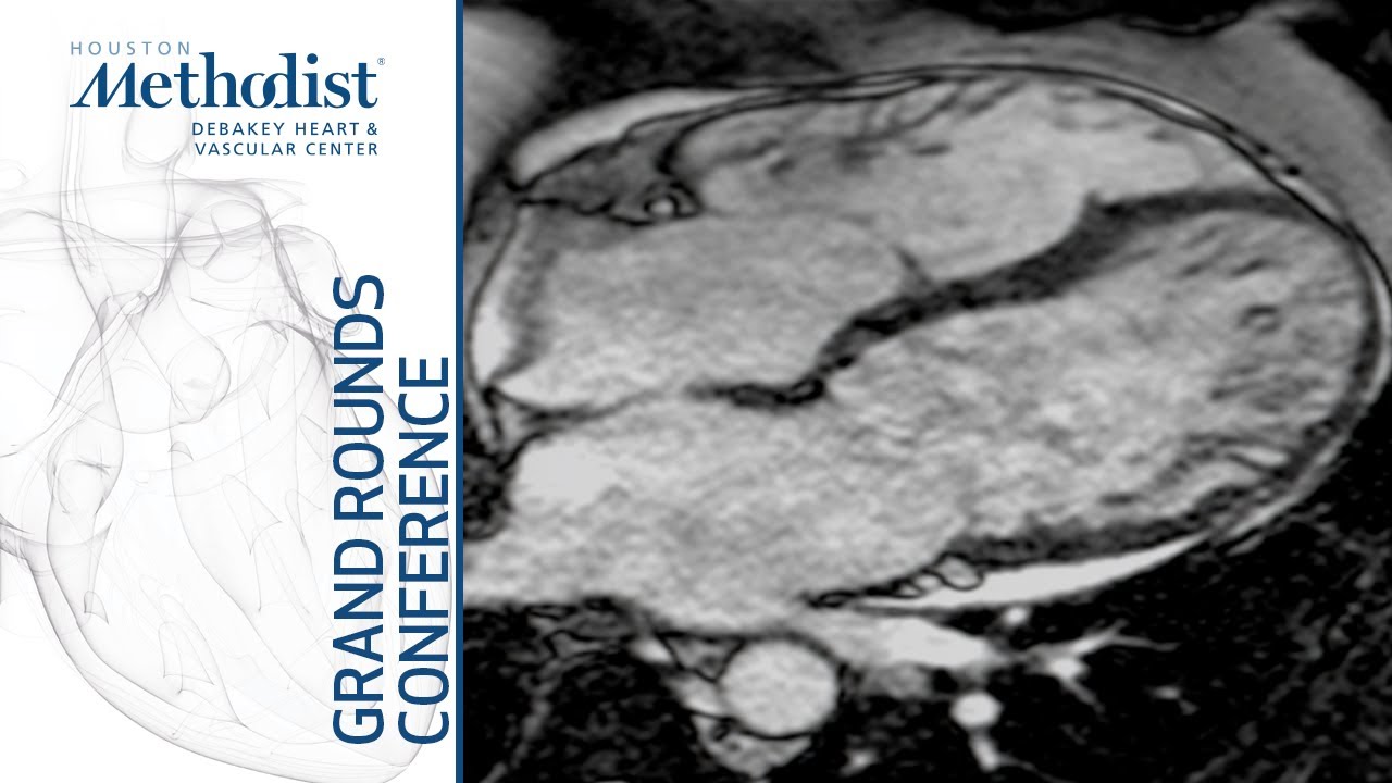 Genetic Cardiomyopathy (Mahwash Kassi, MD) January 9, 2020