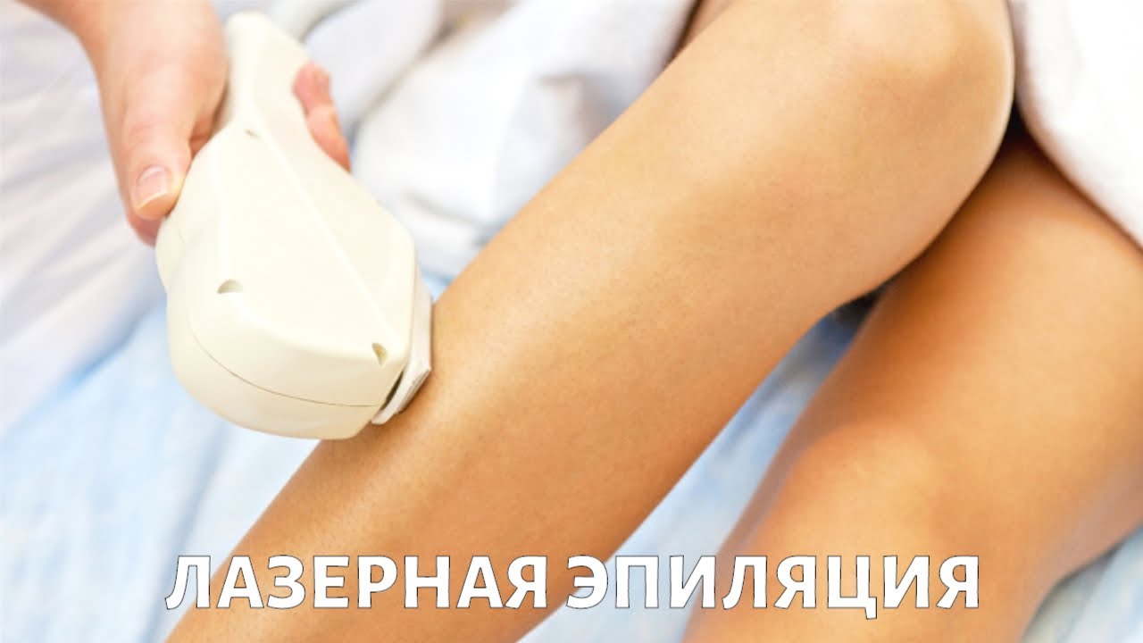 Вся правда о лазерной ЭПИЛЯЦИИ