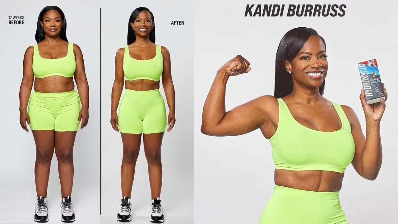 Kandi Burruss Reveals the Secret to Her 31-Pound Weight Loss at 48! 💪✨ #UnBigMyBack