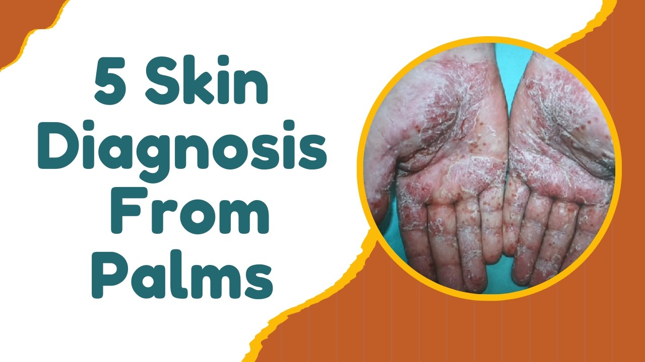 5 Skin Diagnosis From Palms