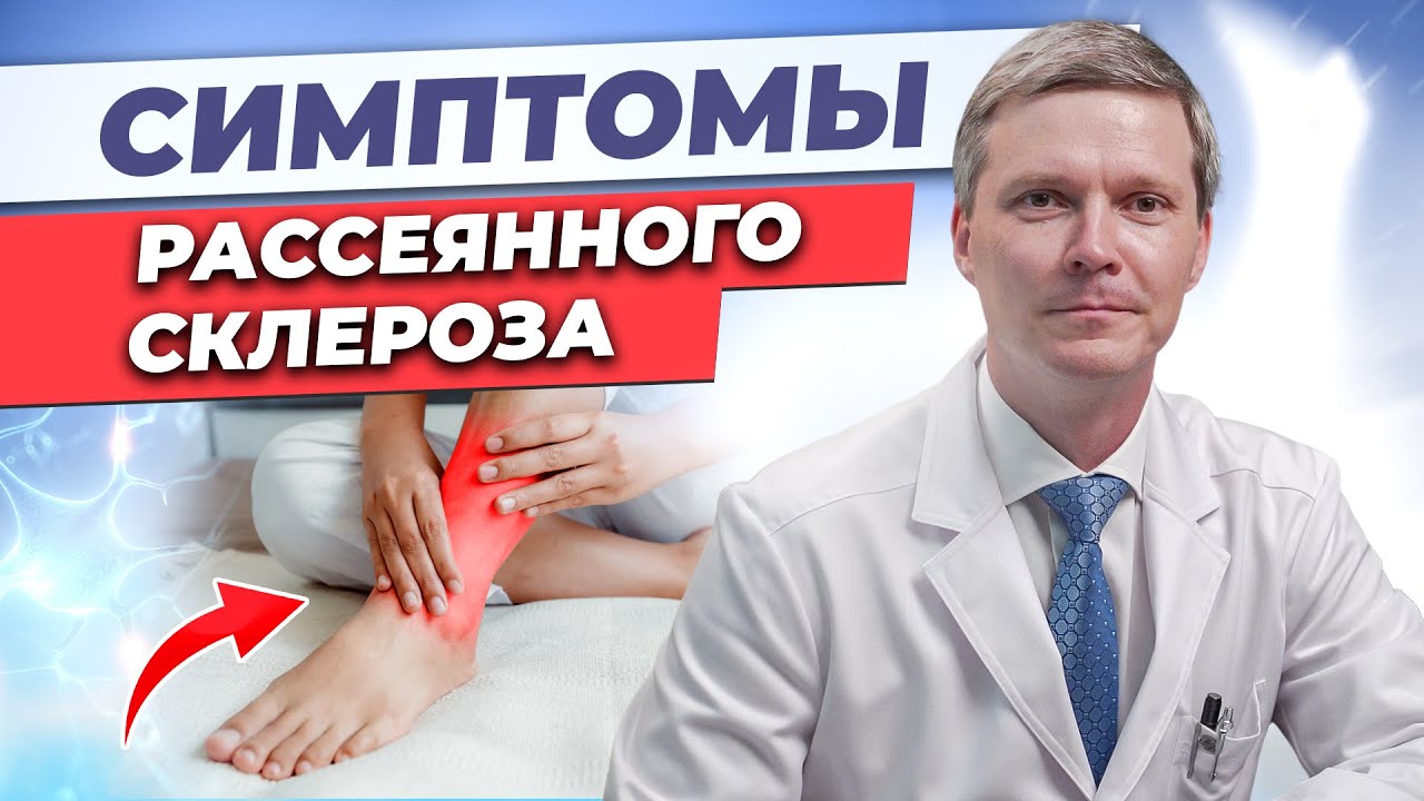 Как проявляется РС? Симптомы рассеянного склероза