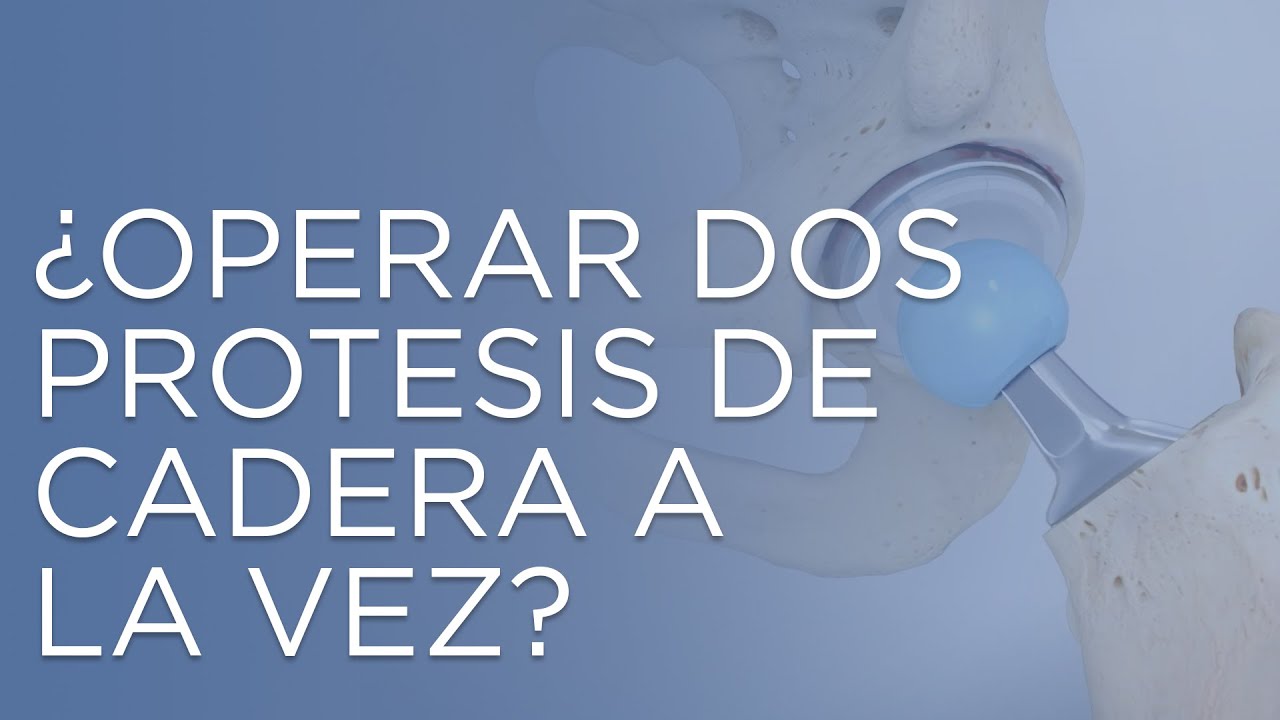 Operar dos caderas a la vez.