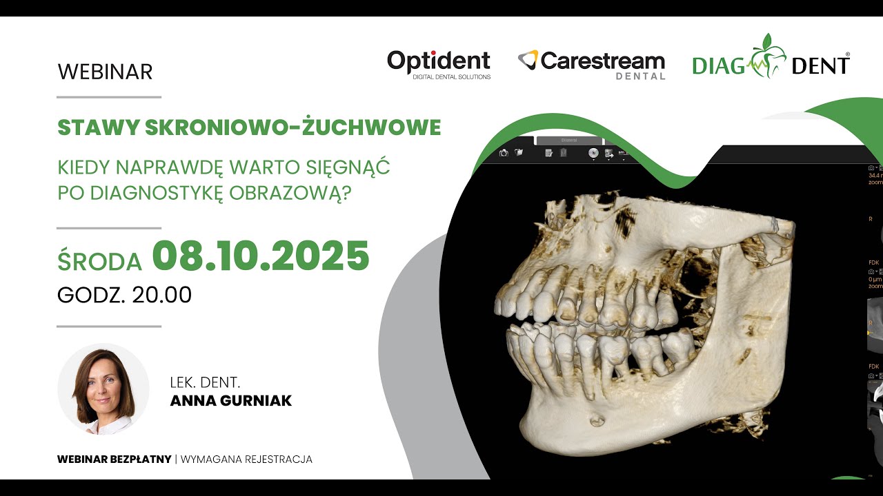 Webinar: Stawy skroniowo żuchwowe. Kiedy naprawdę warto sięgnąć po diagnostykę obrazową?