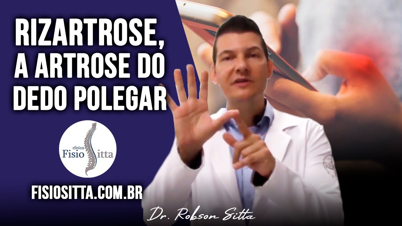 RIZARTROSE ARTROSE do POLEGAR PROTOCOLO de TRATAMENTO em CASA Clínica Fisioterapia Dr. Robson Sitta