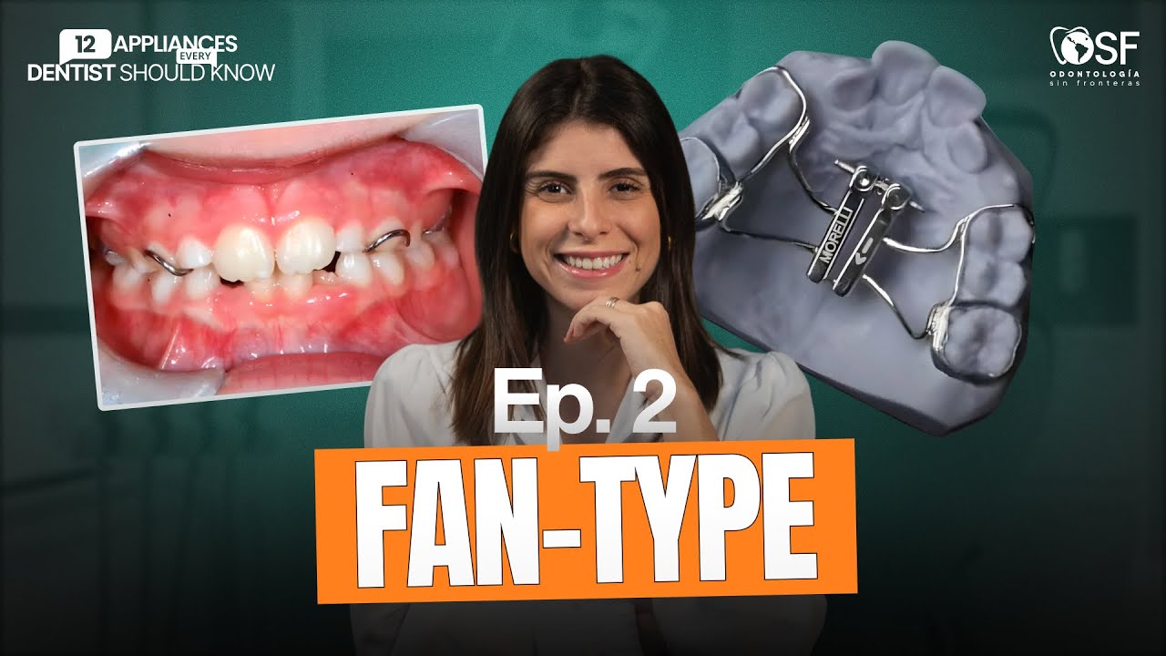 Ep.2 - Before You Activate the Fan-Type, Watch This