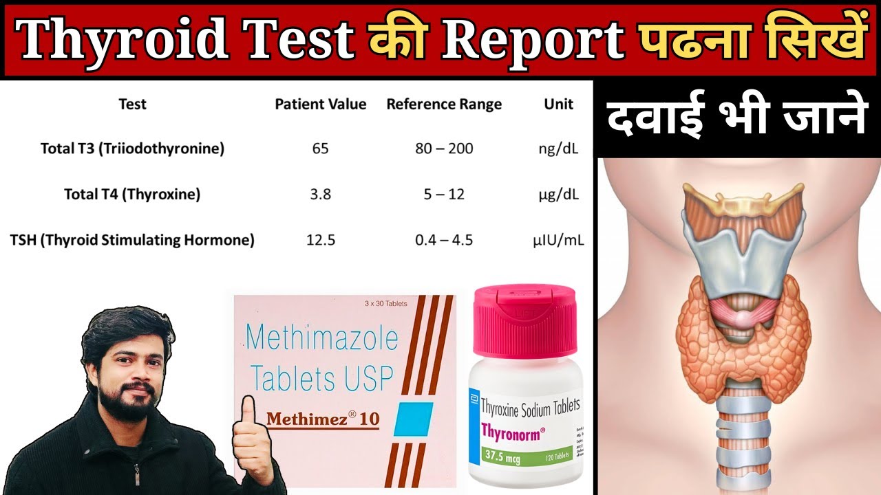 Thyroid Report Kaise Check Kare | Thyroid Profile Test || T3, T4, TSH | Thyroid Function Test Report