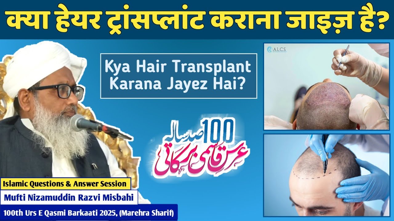 Hair Transplant Karana Kaisa Hai? || Mufti Nizamuddin Misbahi Sahab || जाइज़ या नाजाइज़?
