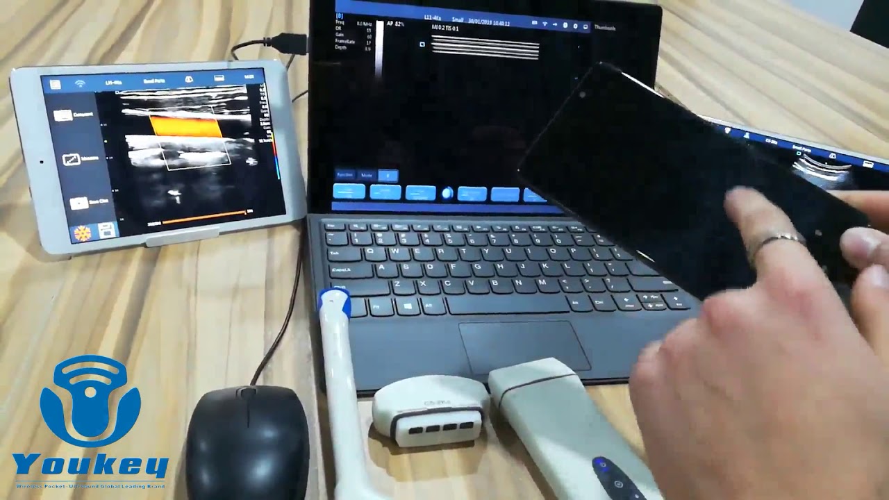 Youkey D8 Wireless Pocket Ultrasound system brief Introduction